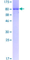 12.5% SDS-PAGE Stained with Coomassie Blue.
